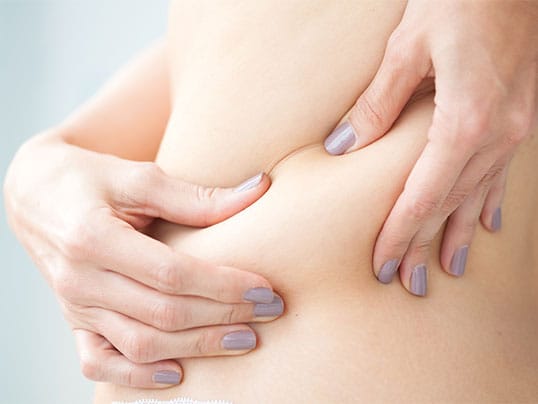 patient considering fat reduction procedures in Fort Lauderdale