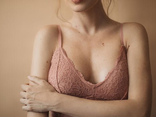 woman after getting motiva breast implants in Florida